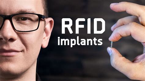 veterenian who removes rfid tags from human body|rfid implantation in humans.